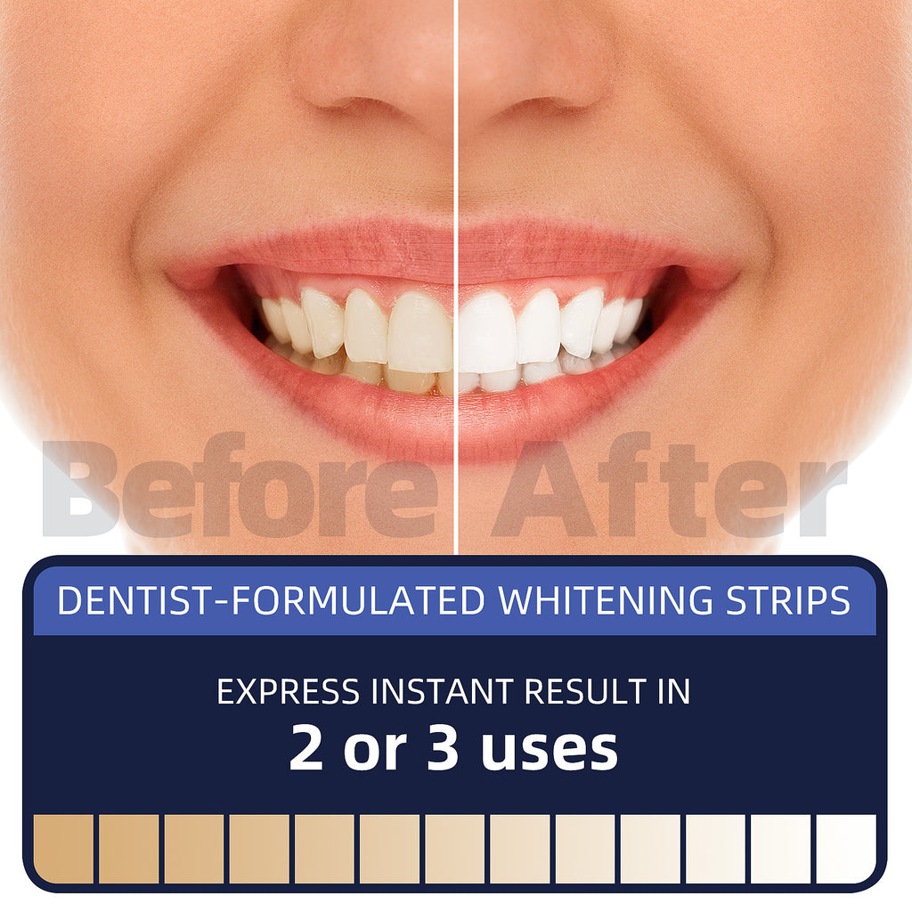 teeth whitening strips