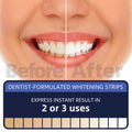 teeth whitening strips