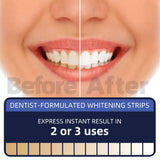 teeth whitening strips