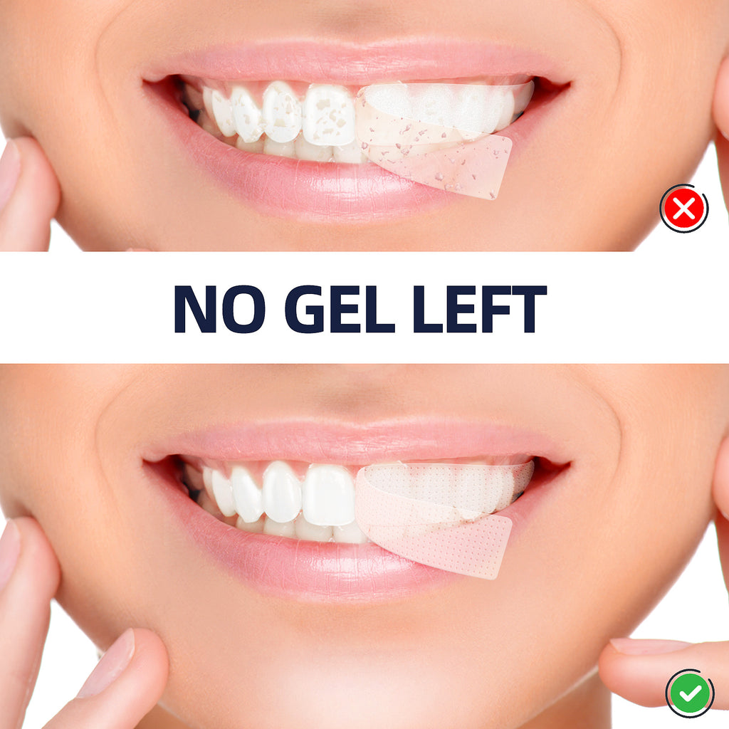 teeth whitening strips