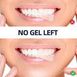 teeth whitening strips